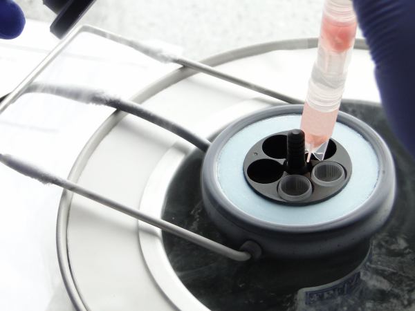 A sample of ovarian tissue being inserted into a cryopreservation chamber