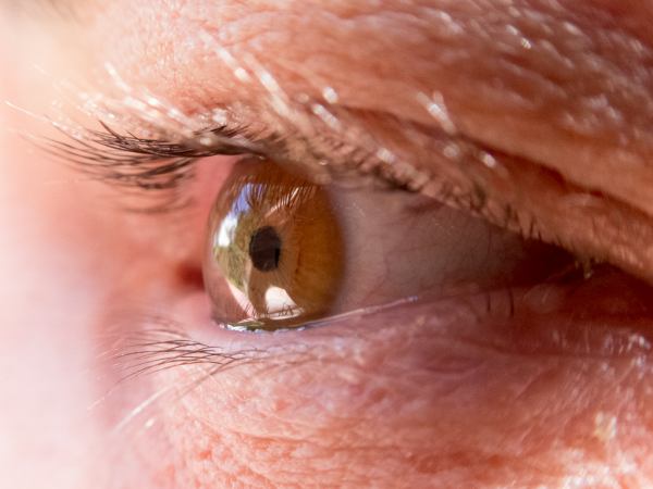 Closeup of an eye