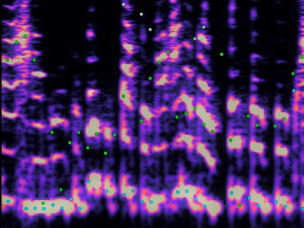 A spectrogram of the sound of a person's voice